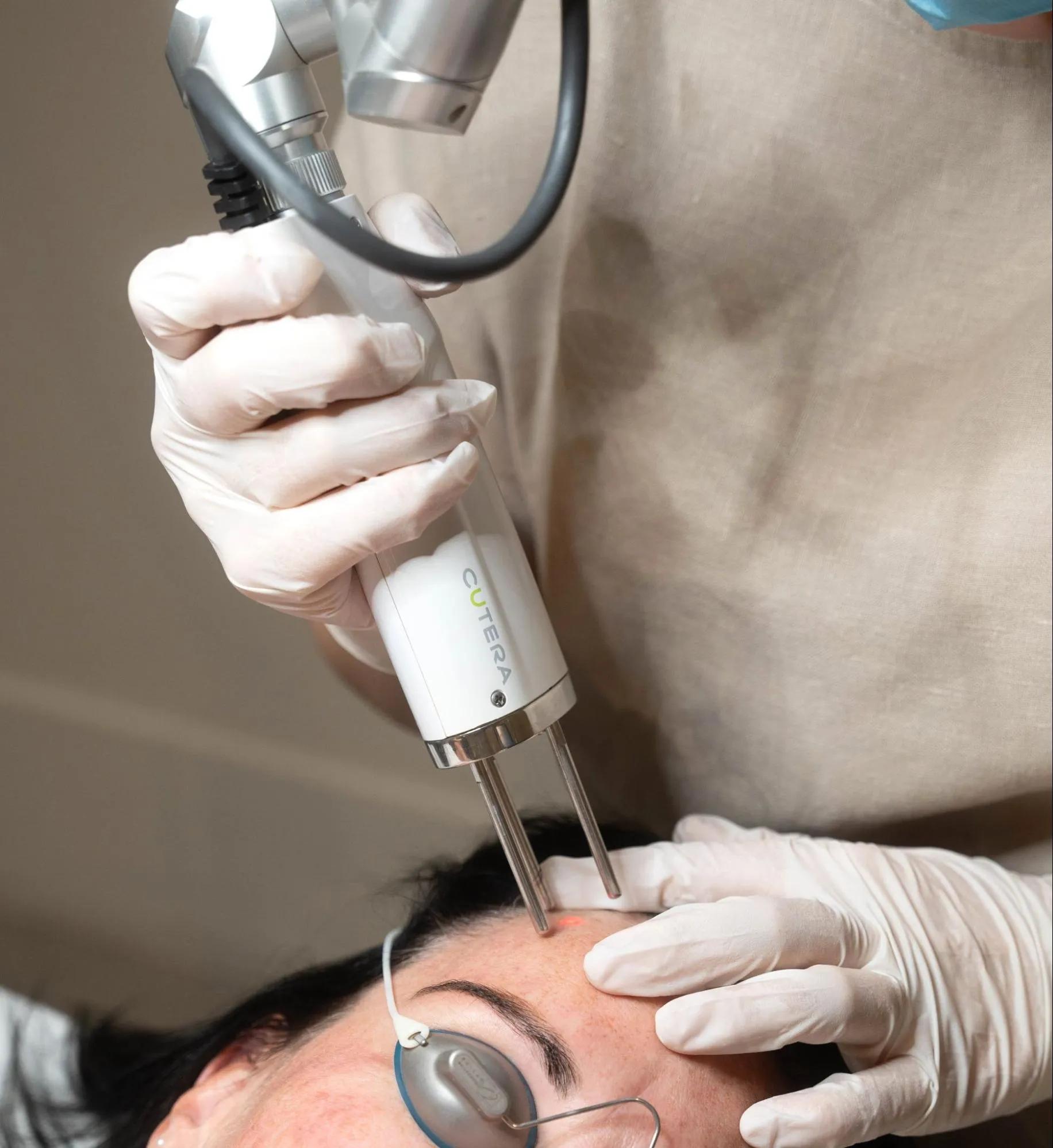 Can Pico Genesis Laser Improve Uneven Skin Texture?